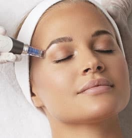 Microneedling with Sherry Cosmetics: A Comprehensive Guide