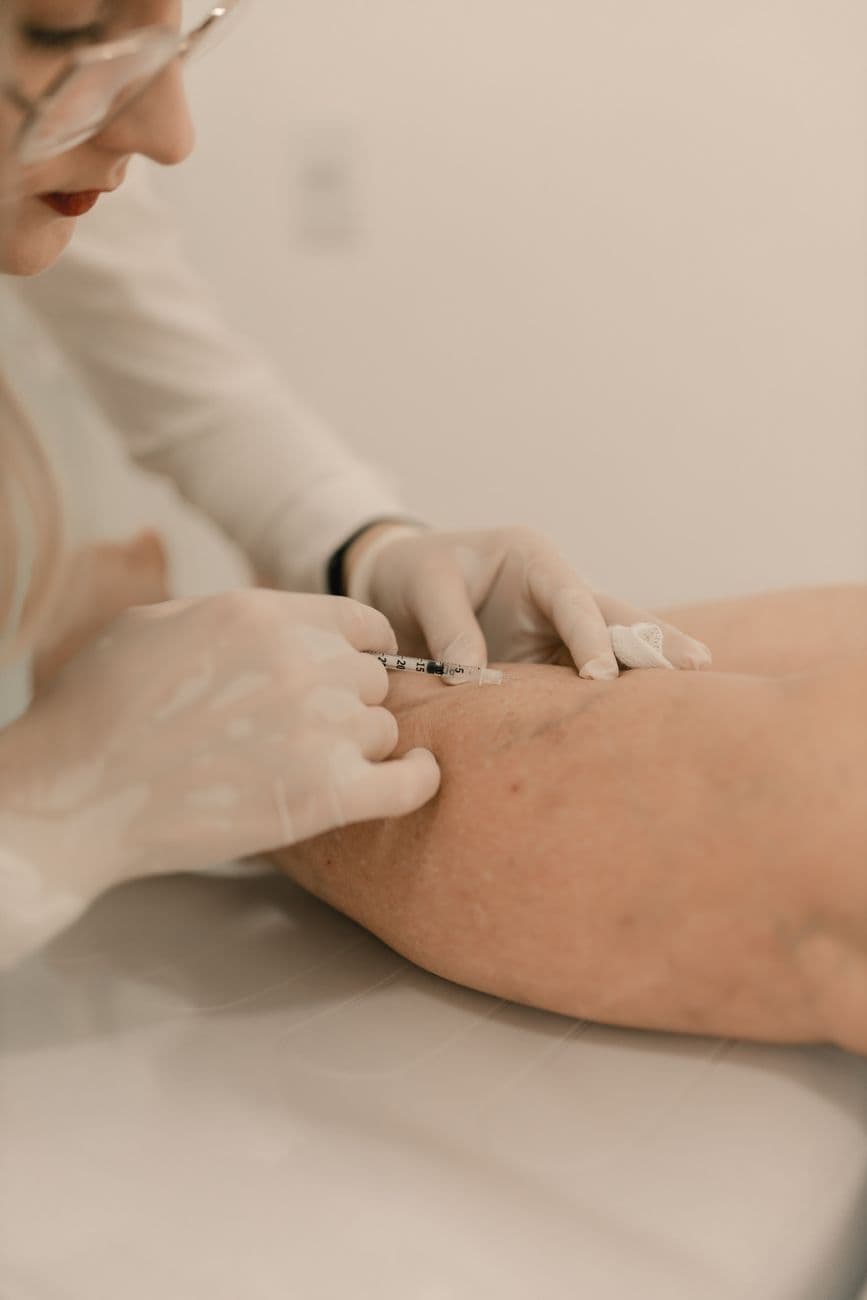 Vascular Treatment for Facial Redness and Spider Veins