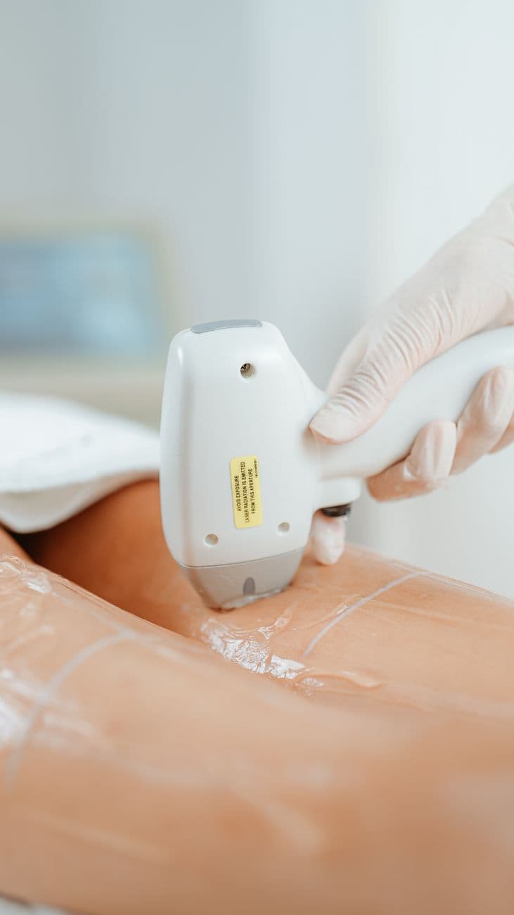 Laser Hair Removal for Ingrown Hairs: Benefits and Safety