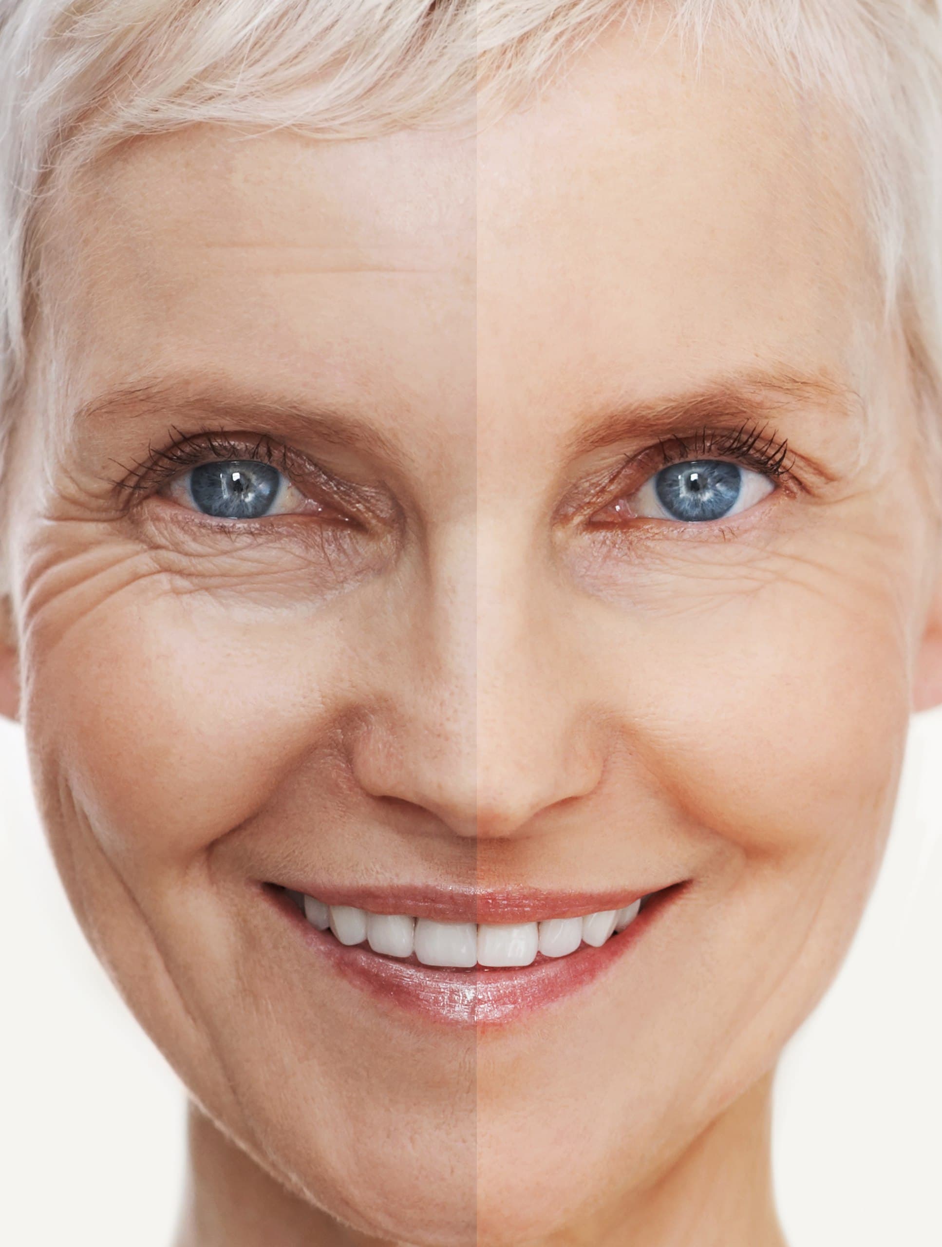 The Magic of Face Sculptra | Sherry Cosmetics
